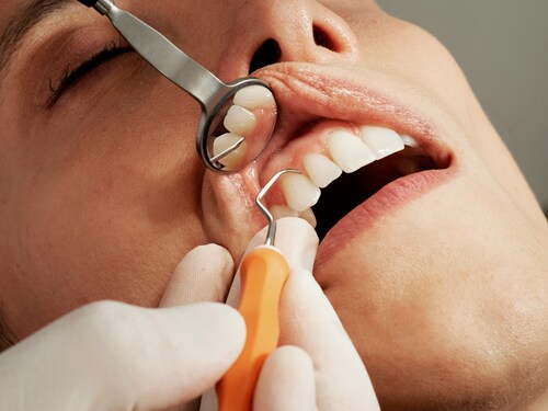 The Importance of Regular Dental Services for Oral Health